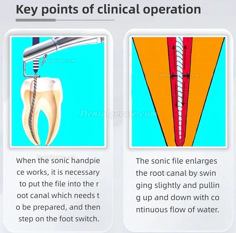 Dental Air Sonic Endo Handst&uuml;ck mit 2 Karton Endo Feilennadeln